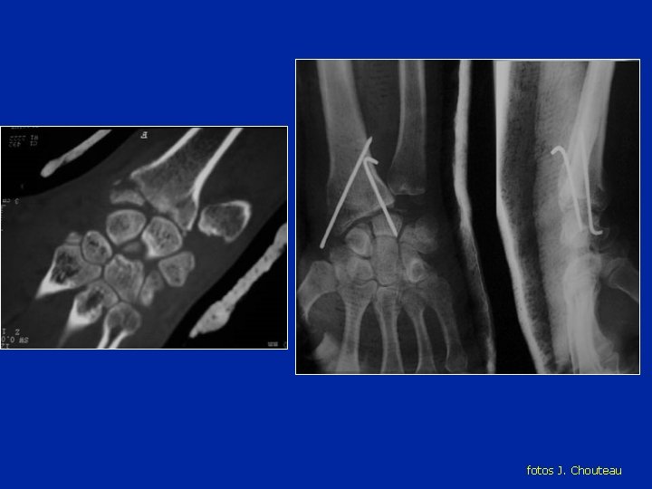 fotos J. Chouteau fotos J. Chouteau