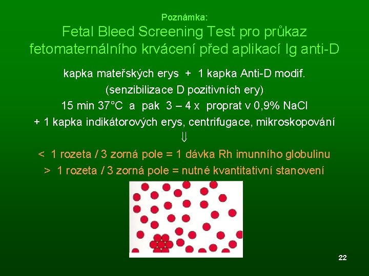 Poznámka: Fetal Bleed Screening Test pro průkaz fetomaternálního krvácení před aplikací Ig anti-D kapka