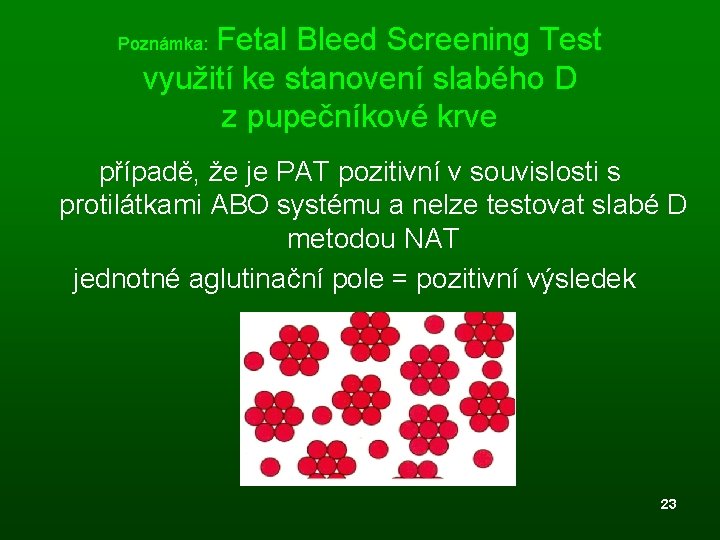  Fetal Bleed Screening Test využití ke stanovení slabého D z pupečníkové krve Poznámka: