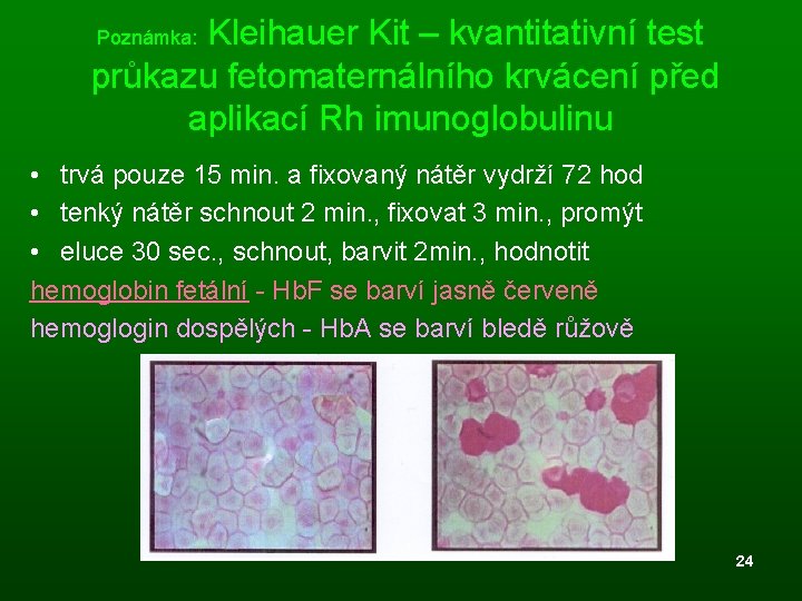  Kleihauer Kit – kvantitativní test průkazu fetomaternálního krvácení před aplikací Rh imunoglobulinu Poznámka: