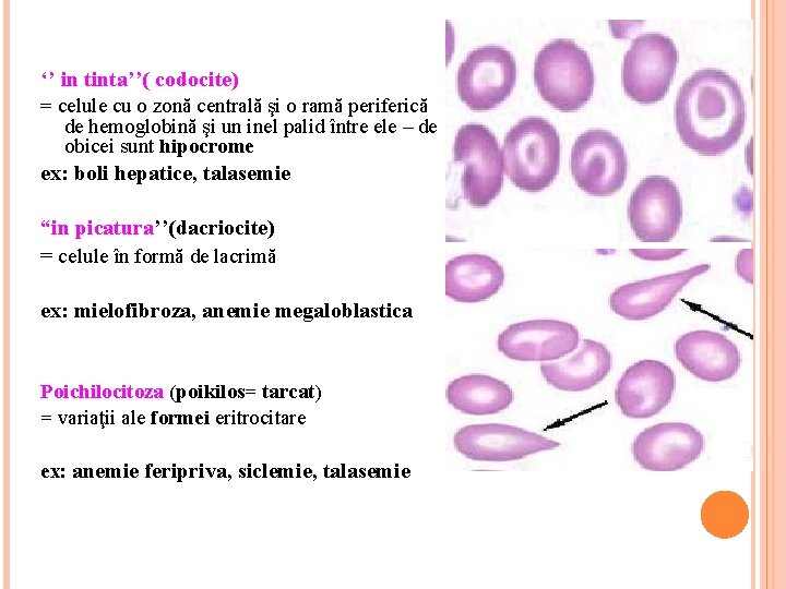 Hemoglobina eritrocitară medie: Ce riscuri se ascund în spatele anemiei