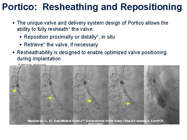 Portico: Resheathing and Repositioning § The unique valve and delivery system design of Portico Portico: Resheathing and Repositioning § The unique valve and delivery system design of Portico