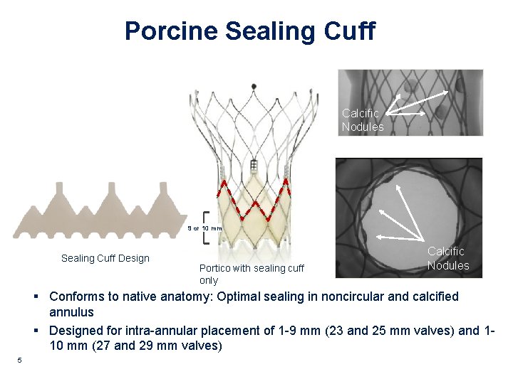 Porcine Sealing Cuff Calcific Nodules 9 or 10 mm Sealing Cuff Design Portico with Porcine Sealing Cuff Calcific Nodules 9 or 10 mm Sealing Cuff Design Portico with