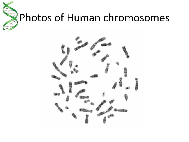 Photos of Human chromosomes 