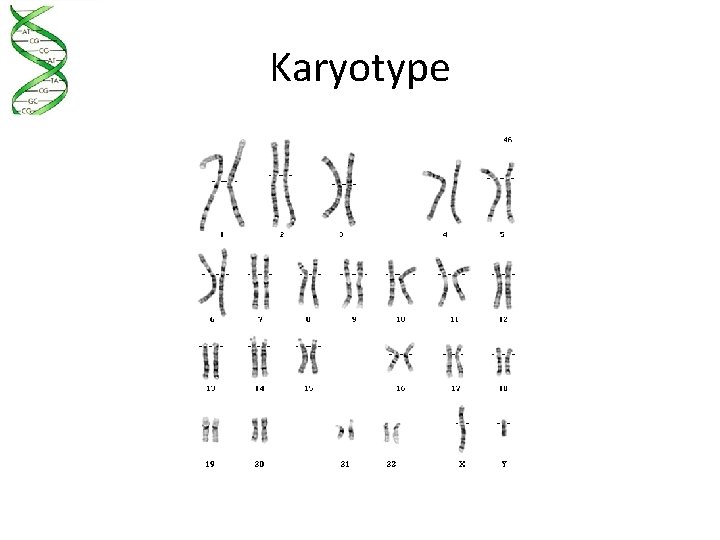 Karyotype 