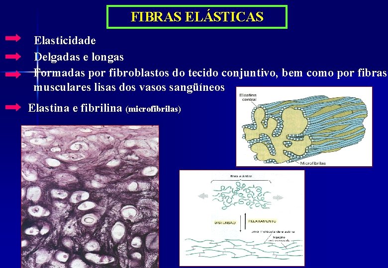 FIBRAS ELÁSTICAS Elasticidade Delgadas e longas Formadas por fibroblastos do tecido conjuntivo, bem como