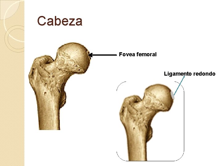 Cabeza Fovea femoral Ligamento redondo 