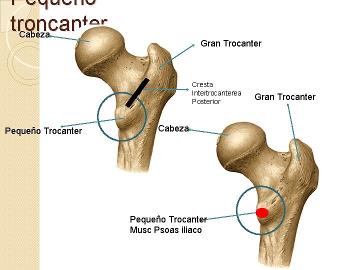 Pequeño troncanter Cabeza Gran Trocanter Cresta Intertrocanterea Posterior Pequeño Trocanter Cabeza Pequeño Trocanter Musc