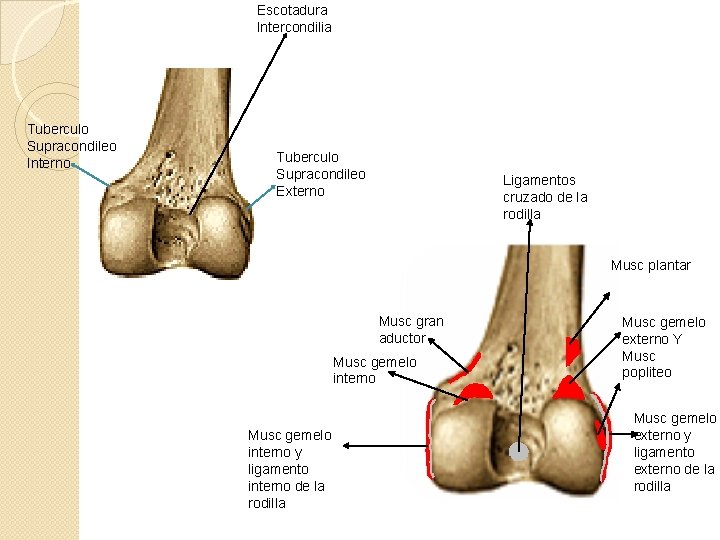 Escotadura Intercondilia Tuberculo Supracondileo Interno Tuberculo Supracondileo Externo Ligamentos cruzado de la rodilla Musc