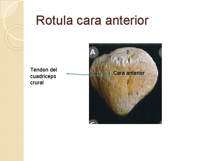 Rotula cara anterior Tendon del cuadriceps crural Cara anterior 
