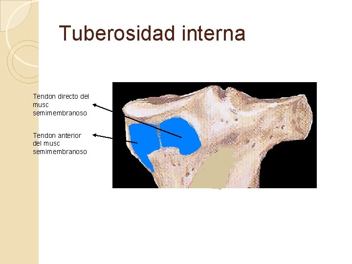 Tuberosidad interna Tendon directo del musc semimembranoso Tendon anterior del musc semimembranoso 