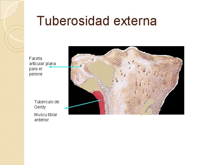 Tuberosidad externa Faceta articular plana para el perone Tuberculo de Gerdy Muscu tibial anterior