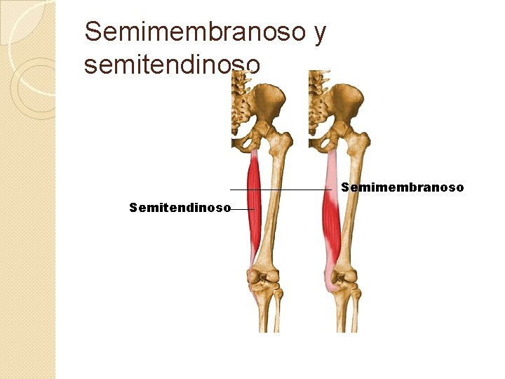 Semimembranoso y semitendinoso Semimembranoso Semitendinoso 