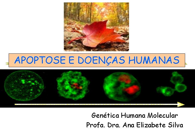 APOPTOSE E DOENÇAS HUMANAS Genética Humana Molecular Profa. Dra. Ana Elizabete Silva 