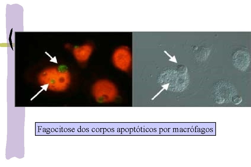 Fagocitose dos corpos apoptóticos por macrófagos 