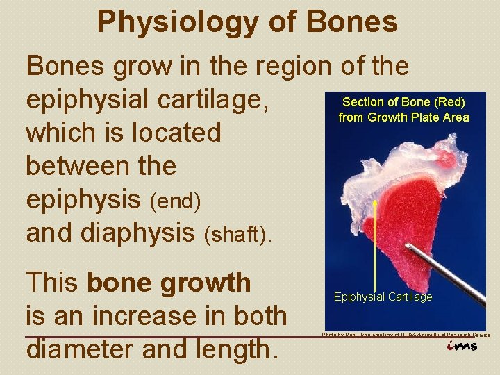 Physiology of Bones grow in the region of the Section of Bone (Red) epiphysial