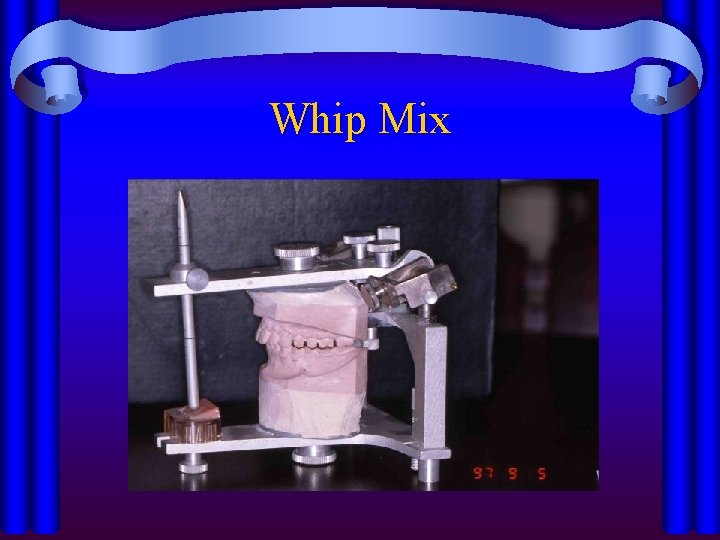 Whip Mix 