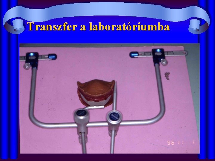 Transzfer a laboratóriumba 