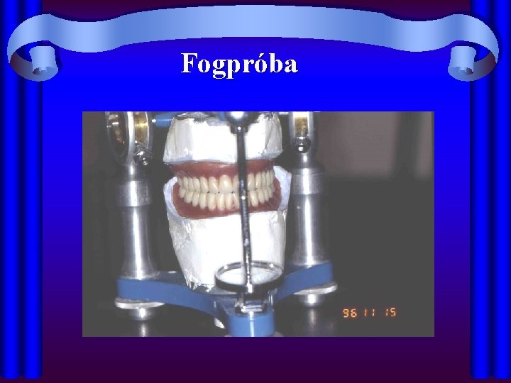 Fogpróba 