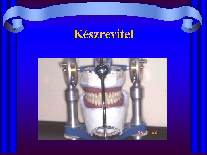 Készrevitel 