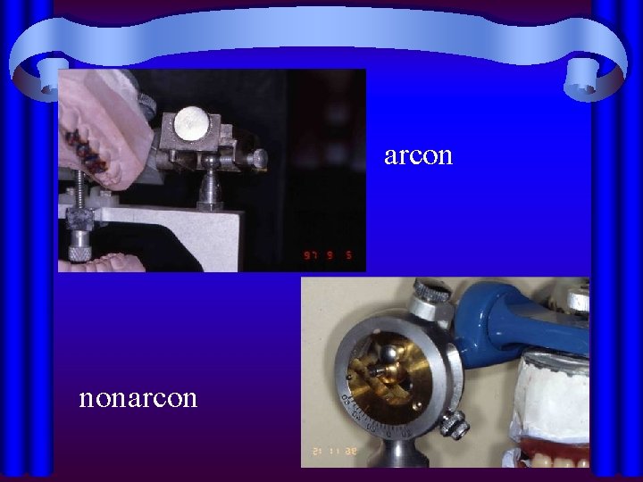 arcon nonarcon 