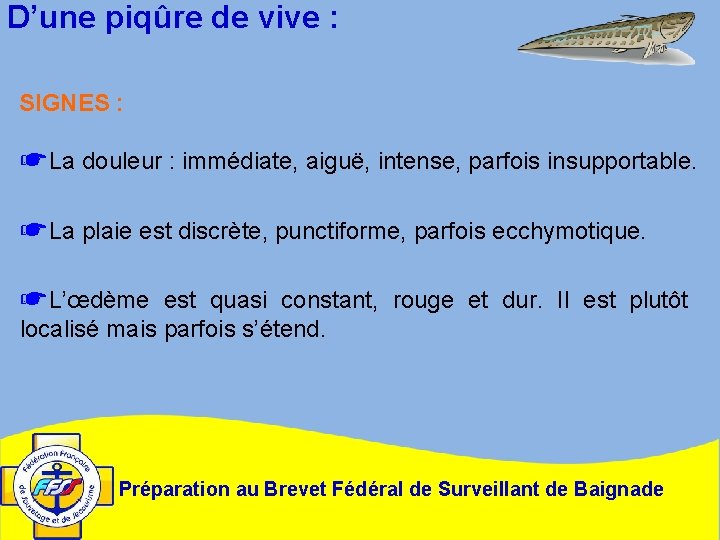 D’une piqûre de vive : SIGNES : ☛La douleur : immédiate, aiguë, intense, parfois