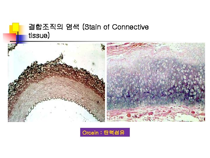 결합조직의 염색 (Stain of Connective tissue) Orcein : 탄력섬유 
