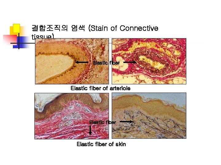 결합조직의 염색 (Stain of Connective tissue) Elastic fiber of arteriole Elastic fiber of skin