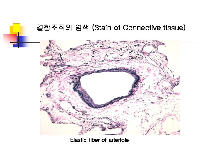결합조직의 염색 (Stain of Connective tissue) Elastic fiber of arteriole 