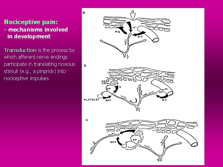 Nociceptive pain: - mechanisms involved in development Transduction is the process by which afferent