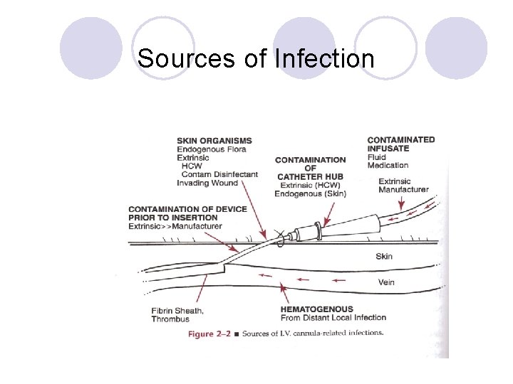 Sources of Infection 