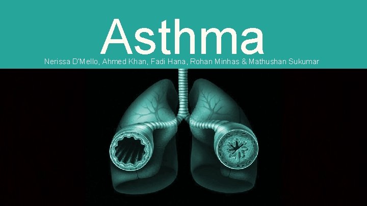 Asthma Nerissa D’Mello, Ahmed Khan, Fadi Hana, Rohan Minhas & Mathushan Sukumar 