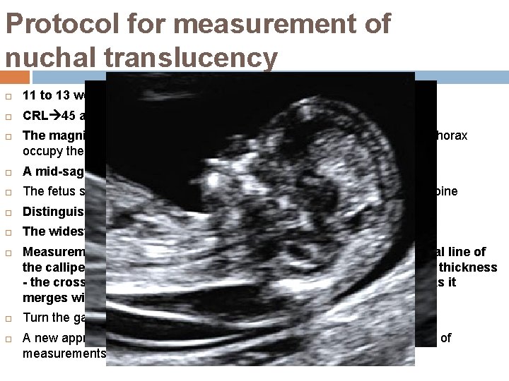 Protocol for measurement of nuchal translucency 11 to 13 weeks 6 days. CRL 45