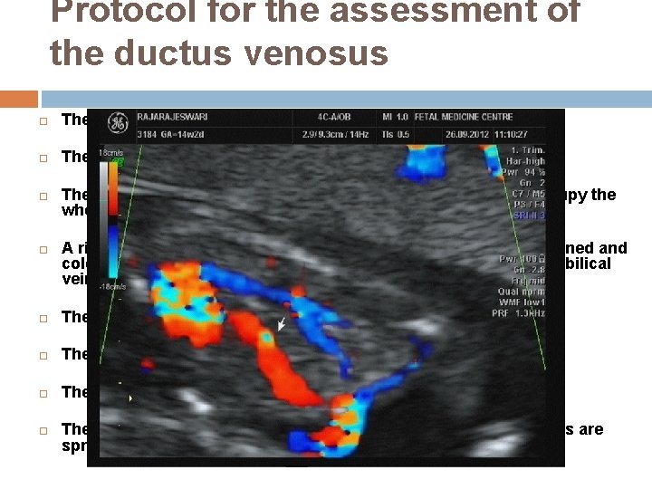 Protocol for the assessment of the ductus venosus The gestational period must be 11