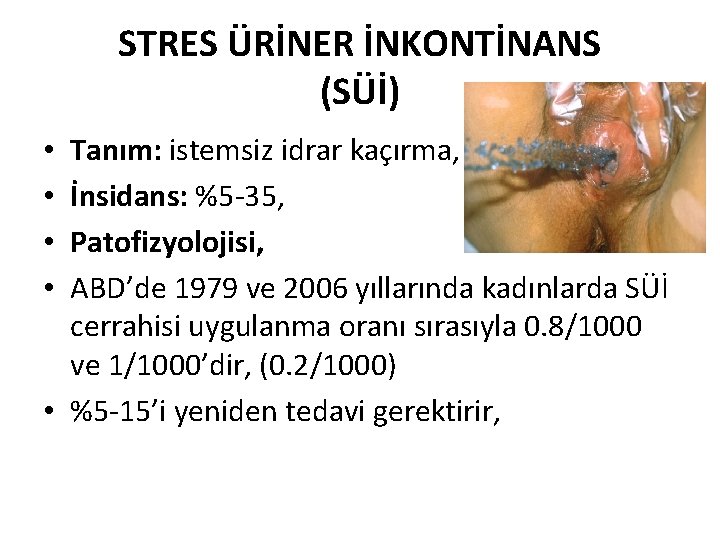 STRES ÜRİNER İNKONTİNANS (SÜİ) Tanım: istemsiz idrar kaçırma, İnsidans: %5 -35, Patofizyolojisi, ABD’de 1979