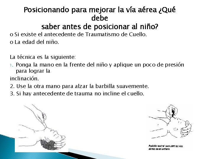 Posicionando para mejorar la vía aérea ¿Qué debe saber antes de posicionar al niño?