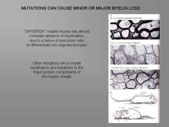 MUTATIONS CAN CAUSE MINOR OR MAJOR MYELIN LOSS “SHIVERER” mutant mouse has almost complete