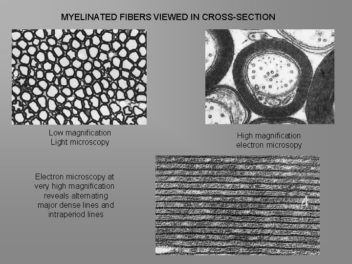 MYELINATED FIBERS VIEWED IN CROSS-SECTION Low magnification Light microscopy Electron microscopy at very high