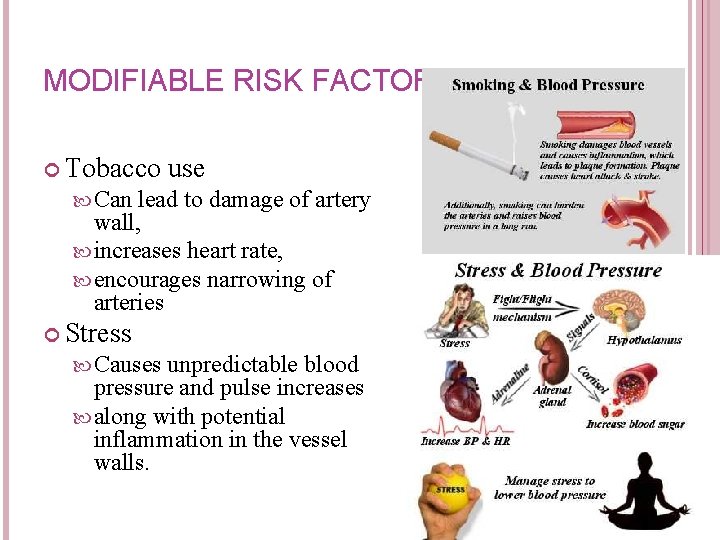 MODIFIABLE RISK FACTORS Tobacco use Can lead to damage of artery wall, increases heart