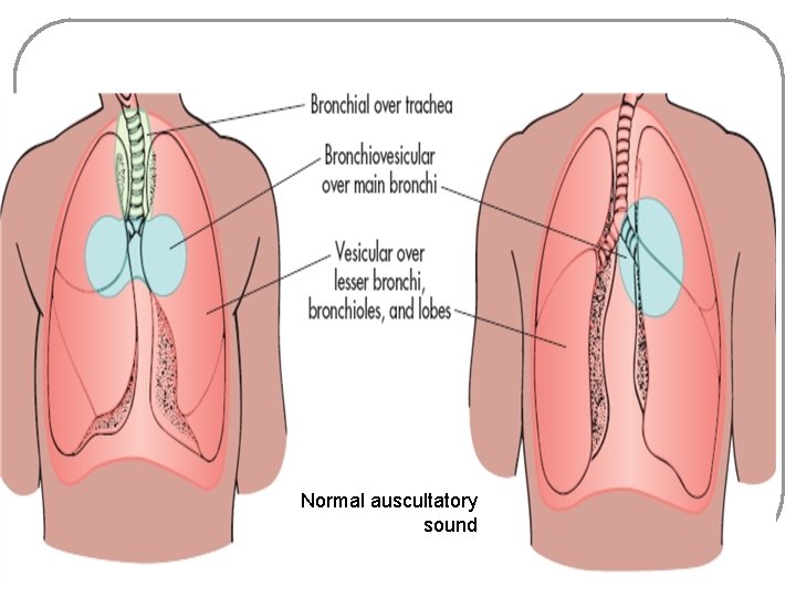 Normal auscultatory sound 