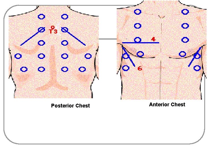 Posterior Chest Anterior Chest 