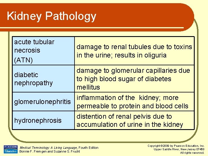 Kidney Pathology acute tubular necrosis (ATN) damage to renal tubules due to toxins in