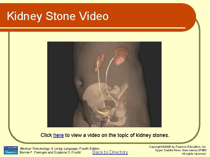 Kidney Stone Video Click here to view a video on the topic of kidney