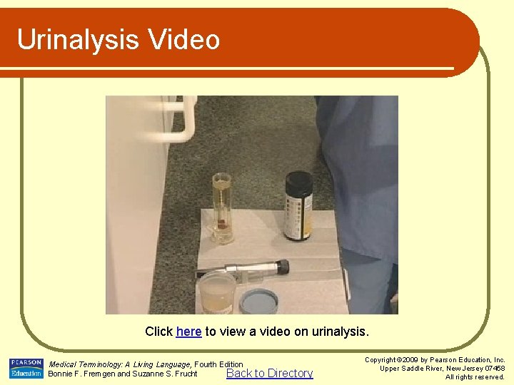 Urinalysis Video Click here to view a video on urinalysis. Medical Terminology: A Living