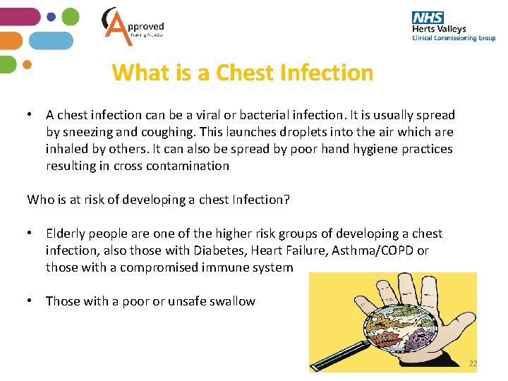 What is a Chest Infection • A chest infection can be a viral or