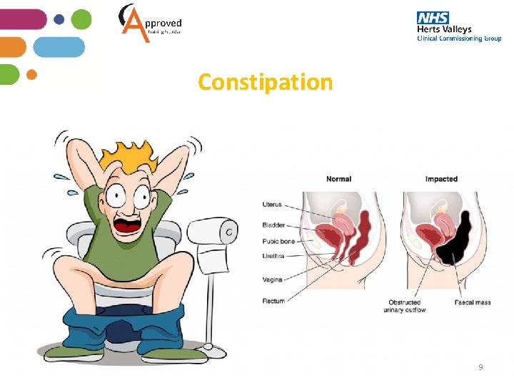 Constipation 9 