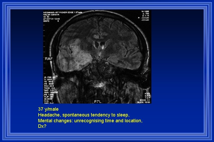 37 y/male Headache, spontaneous tendency to sleep, Mental changes: unrecognising time and location, Dx?