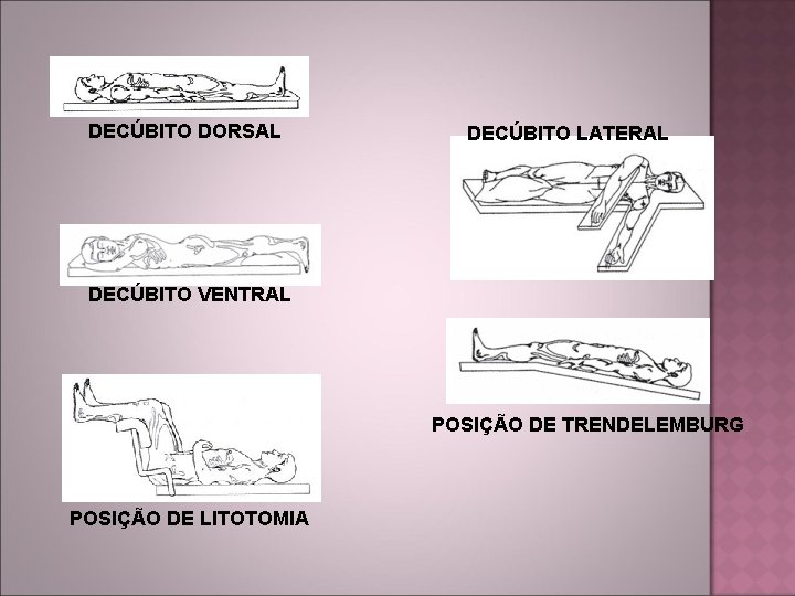  DECÚBITO DORSAL DECÚBITO LATERAL DECÚBITO VENTRAL POSIÇÃO DE TRENDELEMBURG POSIÇÃO DE LITOTOMIA 