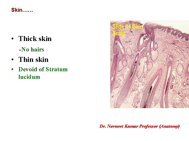 Skin…… • Thick skin -No hairs • Thin skin • Devoid of Stratum lucidum