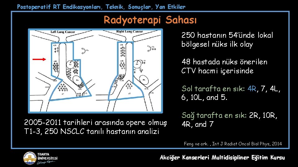 Postoperatif RT Endikasyonları, Teknik, Sonuçlar, Yan Etkiler Radyoterapi Sahası 250 hastanın 54’ünde lokal bölgesel